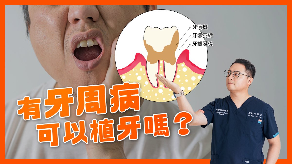 有牙周病可以植牙嗎？